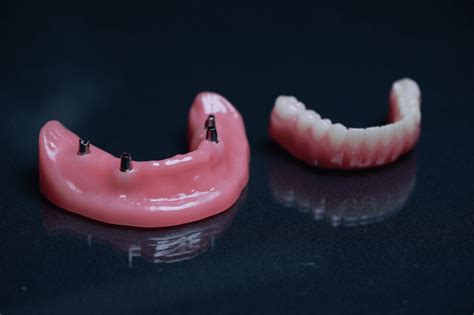 3d printed dentures reviews|Your guide to 3d printed dentures / Dentsply Sirona USA.